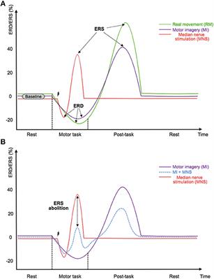 Median Nerve Stimulation Based BCI: A New Approach to Detect Intraoperative Awareness During General Anesthesia